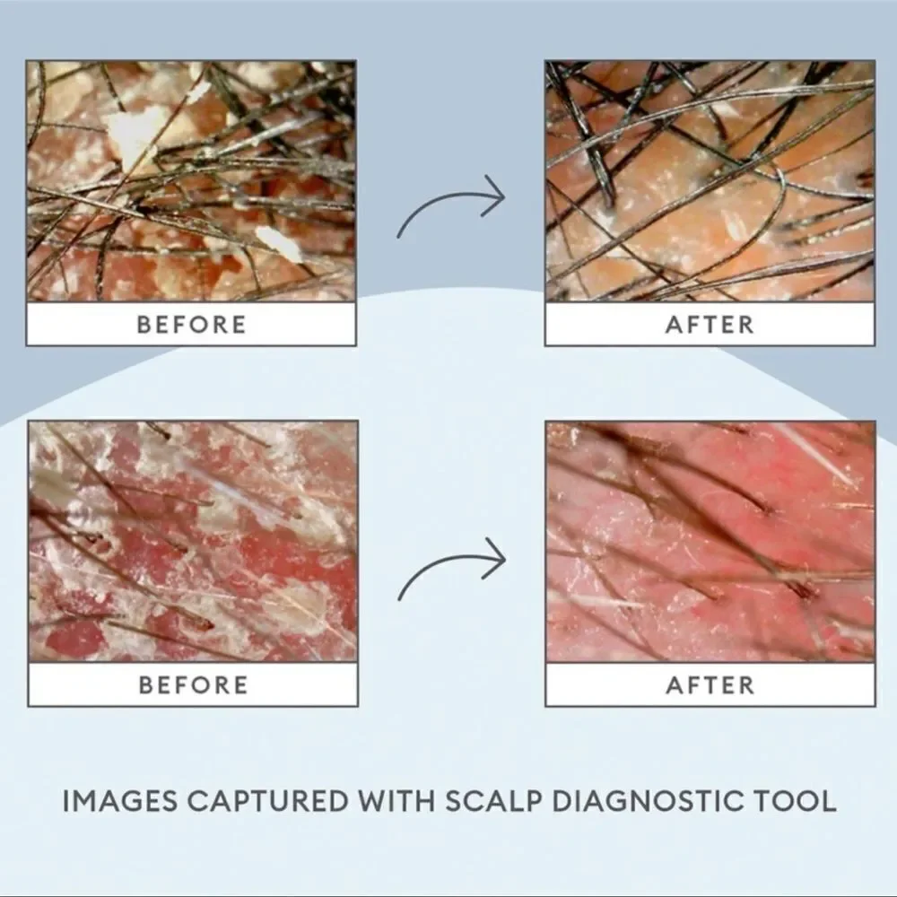 ‎NEW BRIOGEO SCALP REVIVAL CONDITIONER/Mask D7